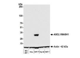 ASCL1/Mash1 Antibody (BLR164J)