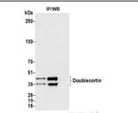 Doublecortin Antibody (BLR168J)