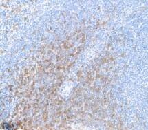 CD8 Antibody (BLR173J)