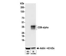CD8 Antibody (BLR173J)