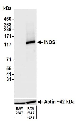 iNOS Antibody (BLR181J)