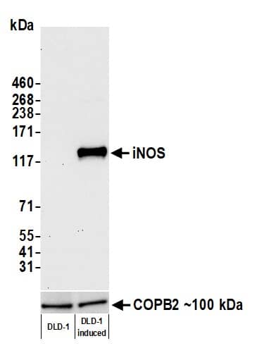 iNOS Antibody (BLR188J)