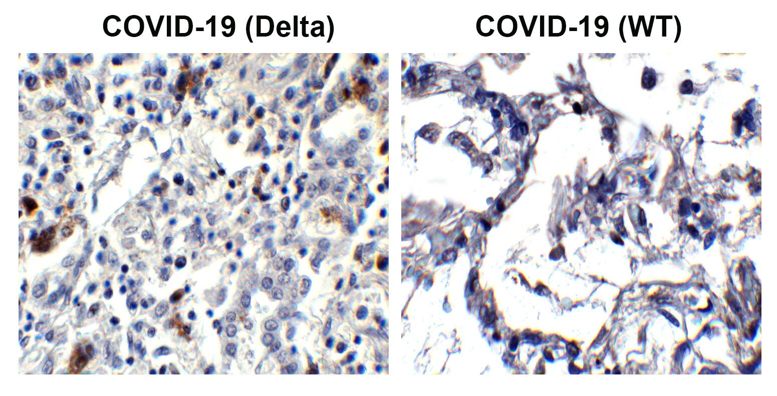 SARS-CoV-2 Spike Antibody (7E3C5) - Delta Variant, B.1.617.2, India - BSA Free