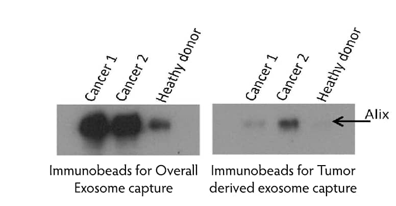 Tumor-Derived Exosome Isolation Beads