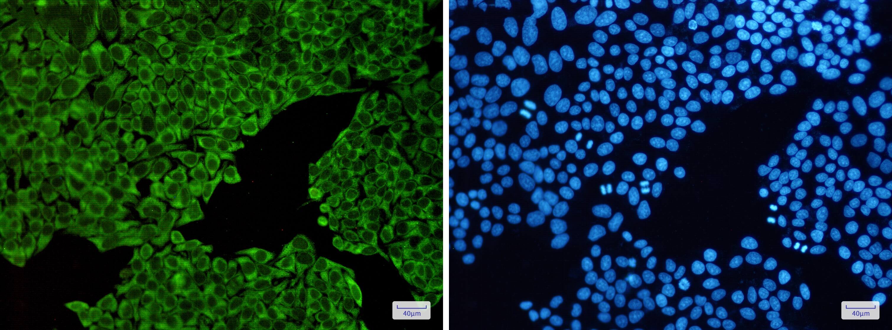 ENO3 Antibody (S07-5B2)