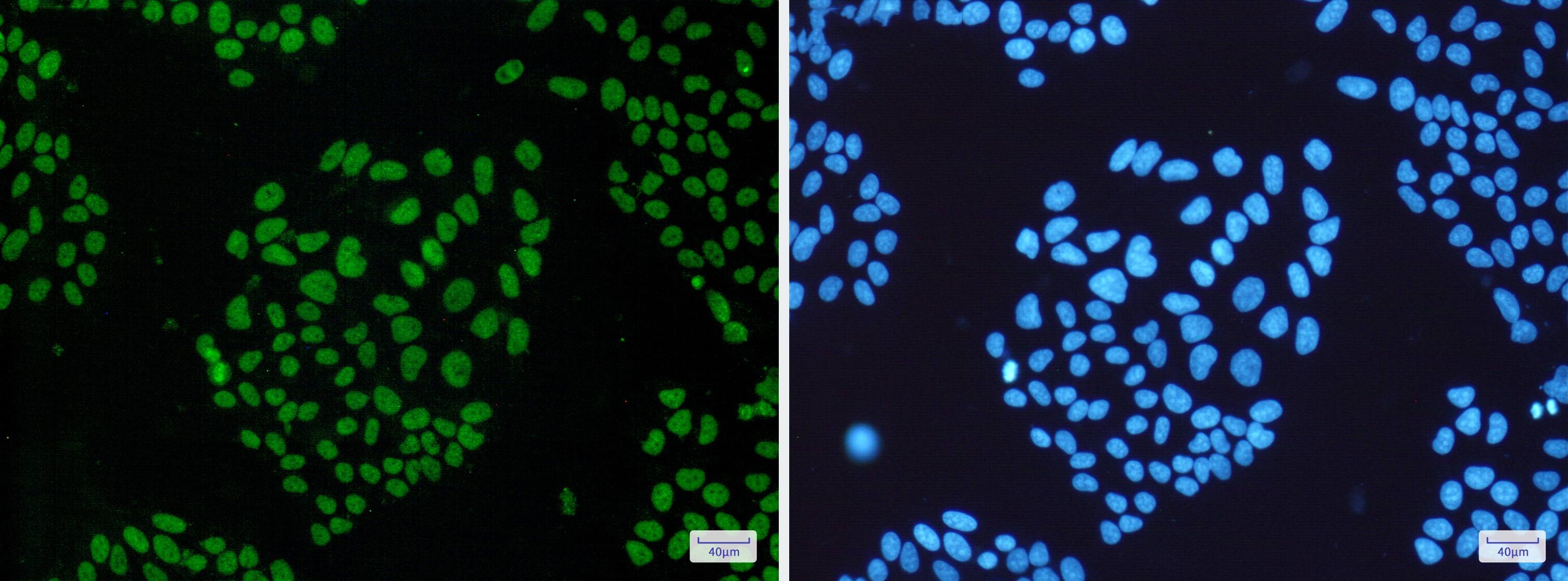 hHpr1-p84-Thoc1 Antibody (S05-1A8)