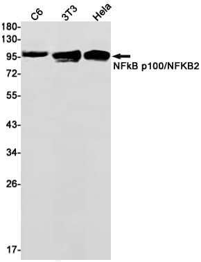 NFkB p100/p52 Antibody (S04-4D6)