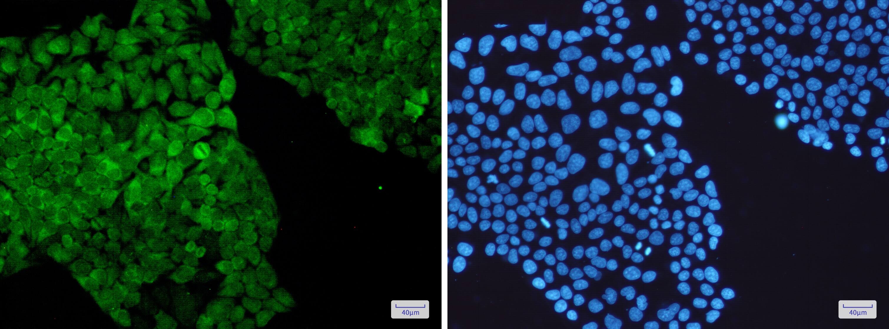 PGK1 Antibody (S04-9H9)