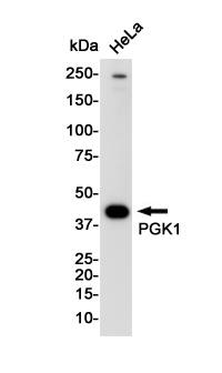 PGK1 Antibody (S04-9H9)