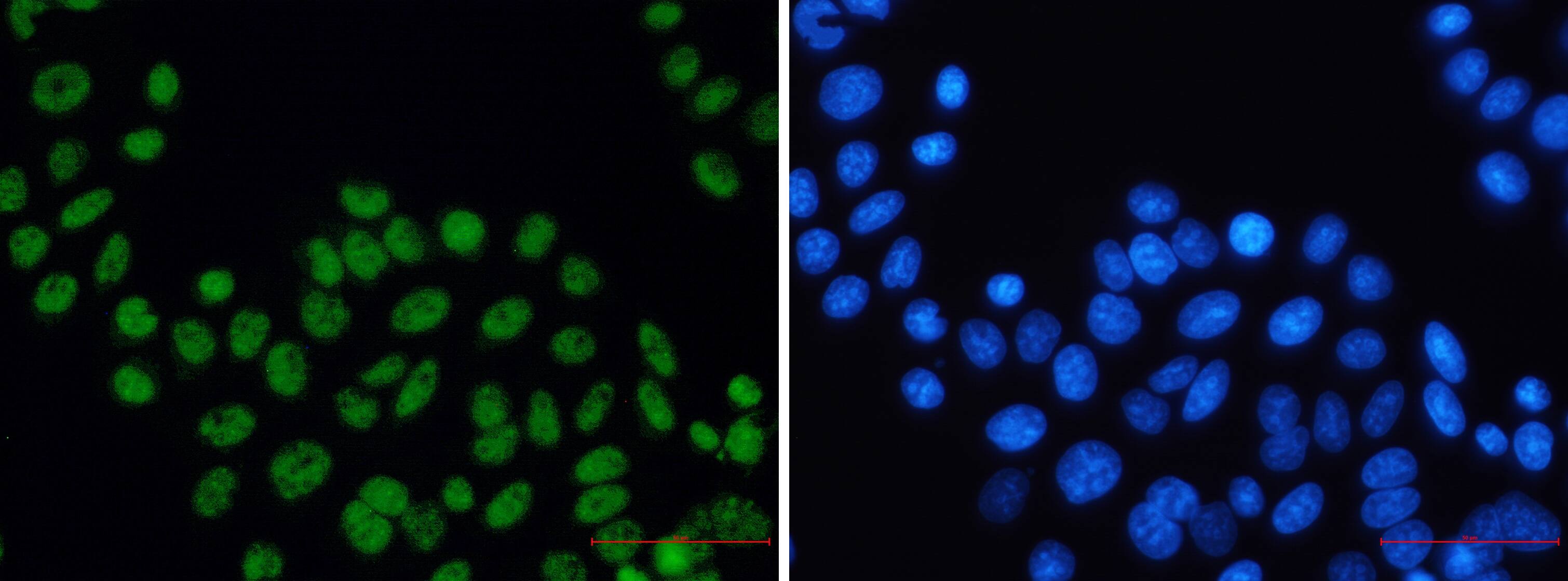 XPD Antibody (S08-2I3)