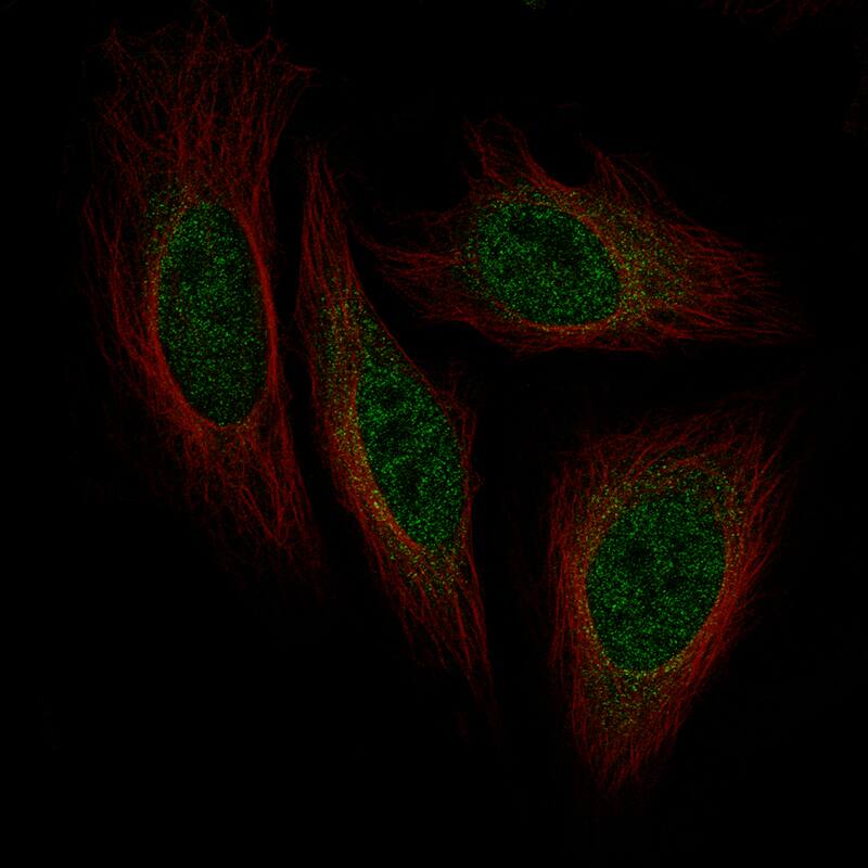 Islet-1 Antibody (CL11651) - BSA Free Immunocytochemistry/ Immunofluorescence: Islet-1 Antibody (CL11651) - BSA Free [NBP3-15121]