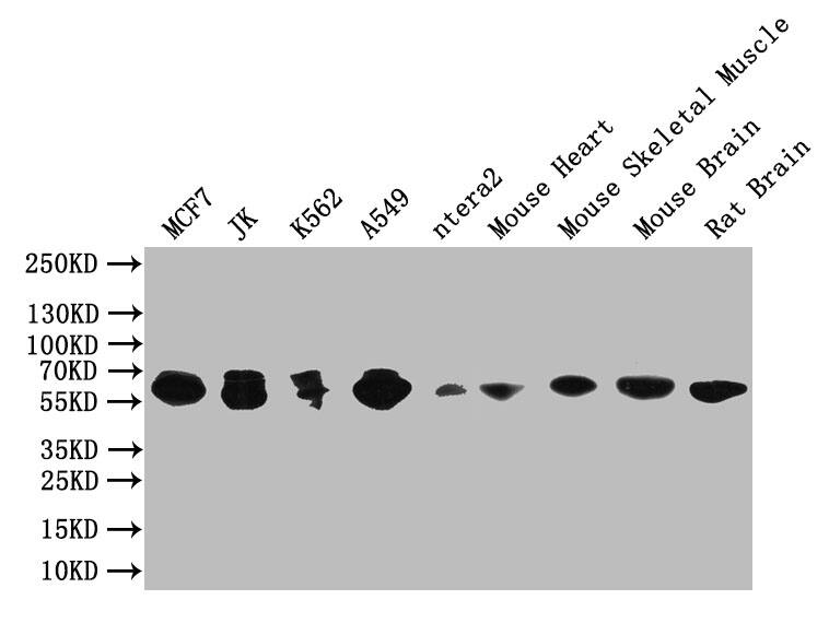 PAK1 Antibody (4F10)