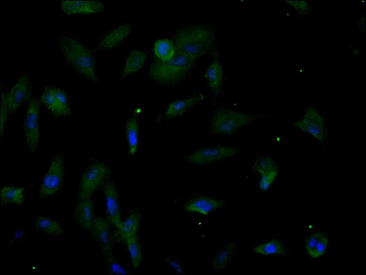 DOT1L Antibody (3B6)