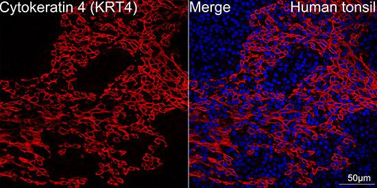 Cytokeratin 4 Antibody (6H9R6)