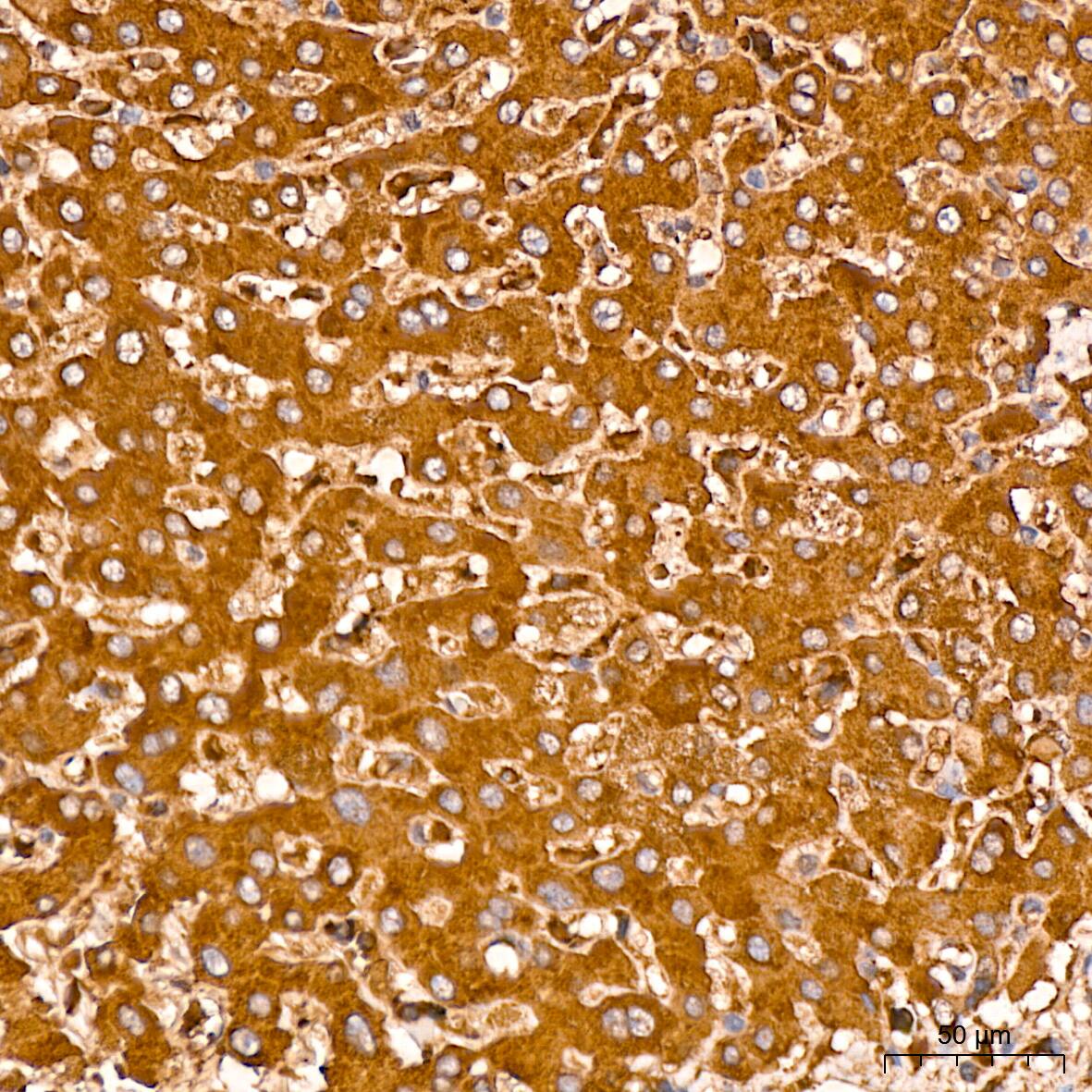 MMP-14/MT1-MMP Antibody (6T7L3)