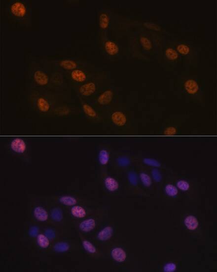 KIFC1 Antibody (10M10J4)