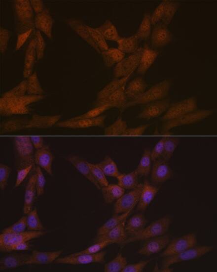 KIFC1 Antibody (10M10J4)
