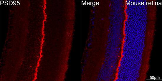 PSD-95 Antibody (0M7N4)