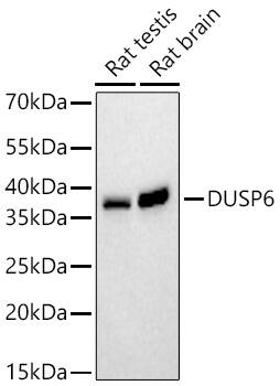 MKP-3/DUSP6 Antibody (1V5L10)