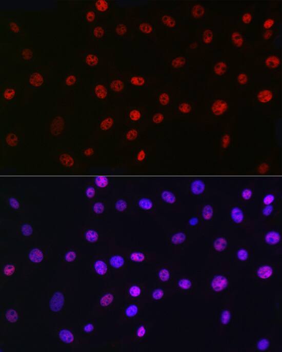 QKI/Quaking Antibody (1D1N6)