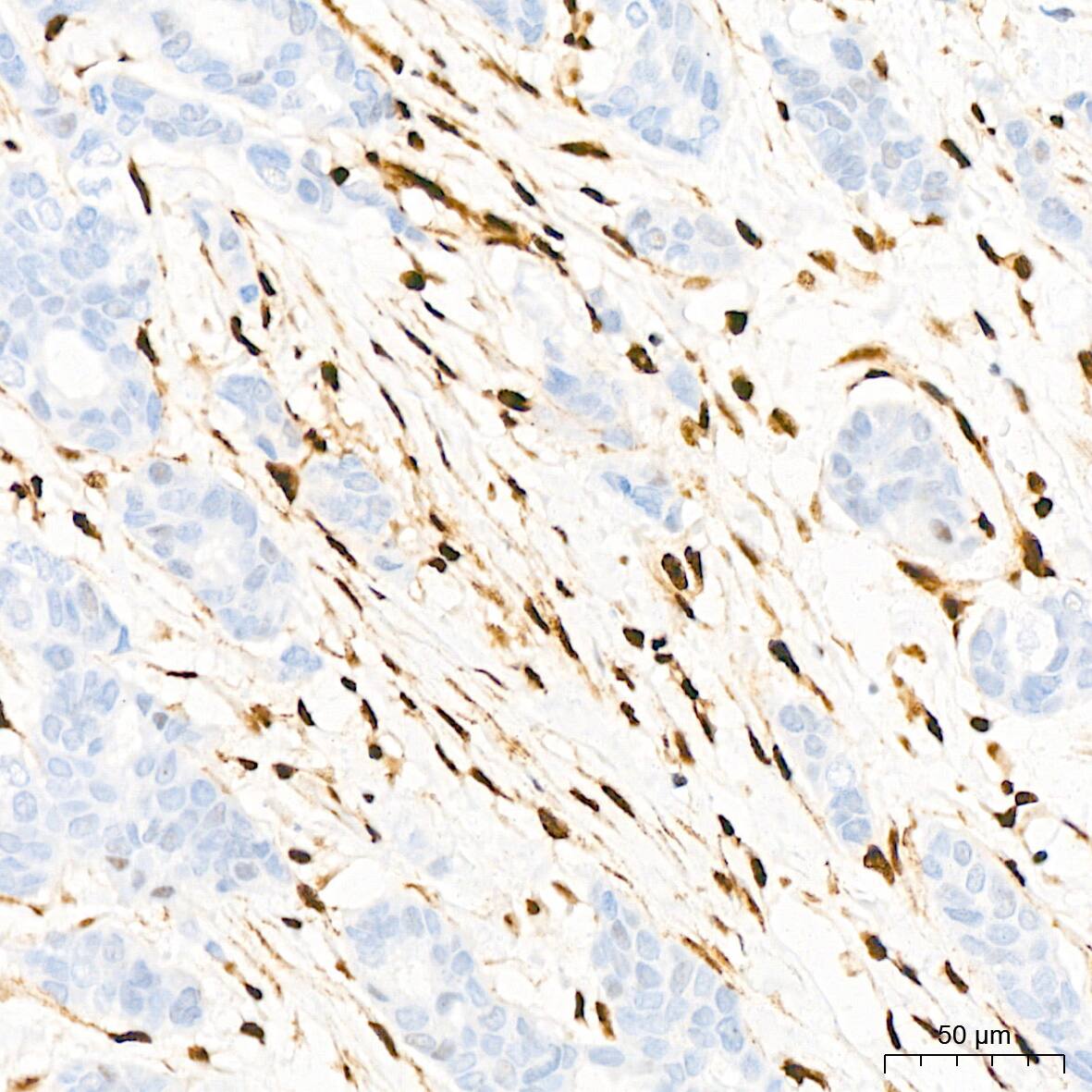 QKI/Quaking Antibody (1D1N6)