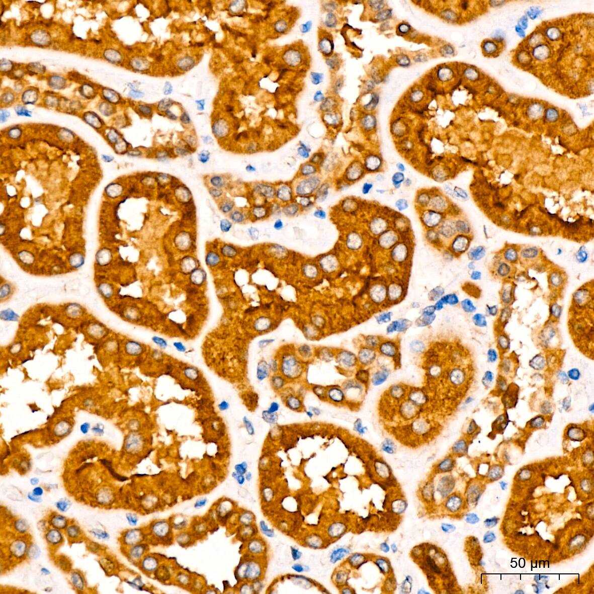 CaM Kinase II Antibody (9P2E2)
