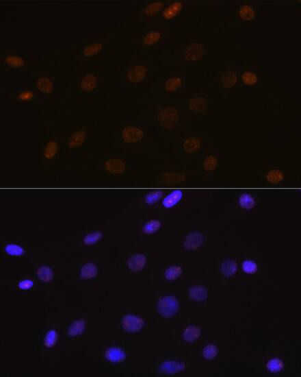 DEK Antibody (2C2V8)