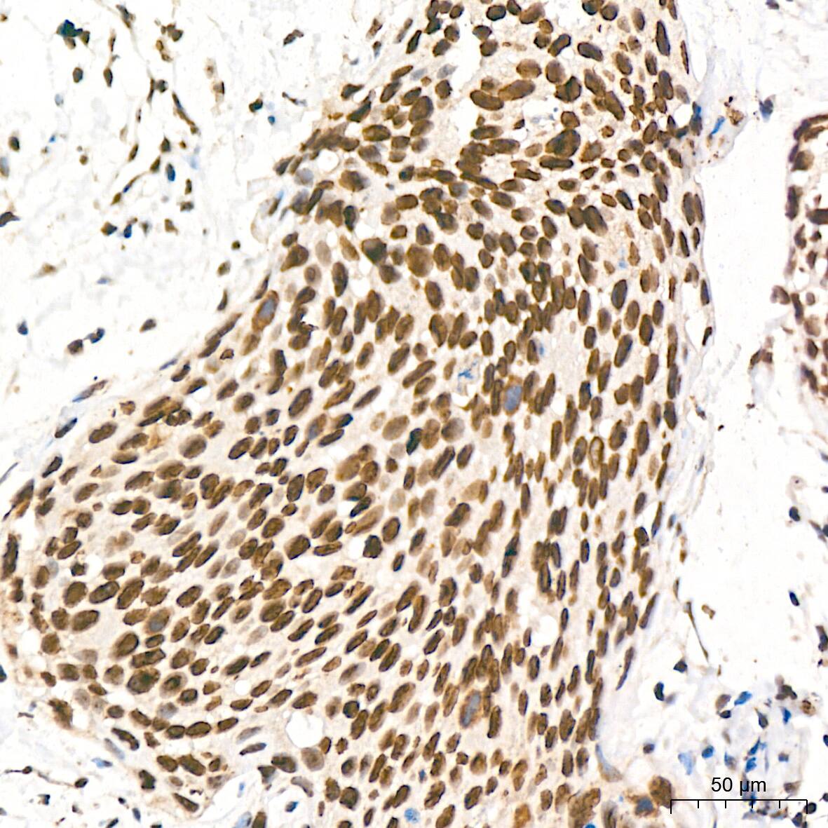 HR6B/UBE2B Antibody (2Z3R2)