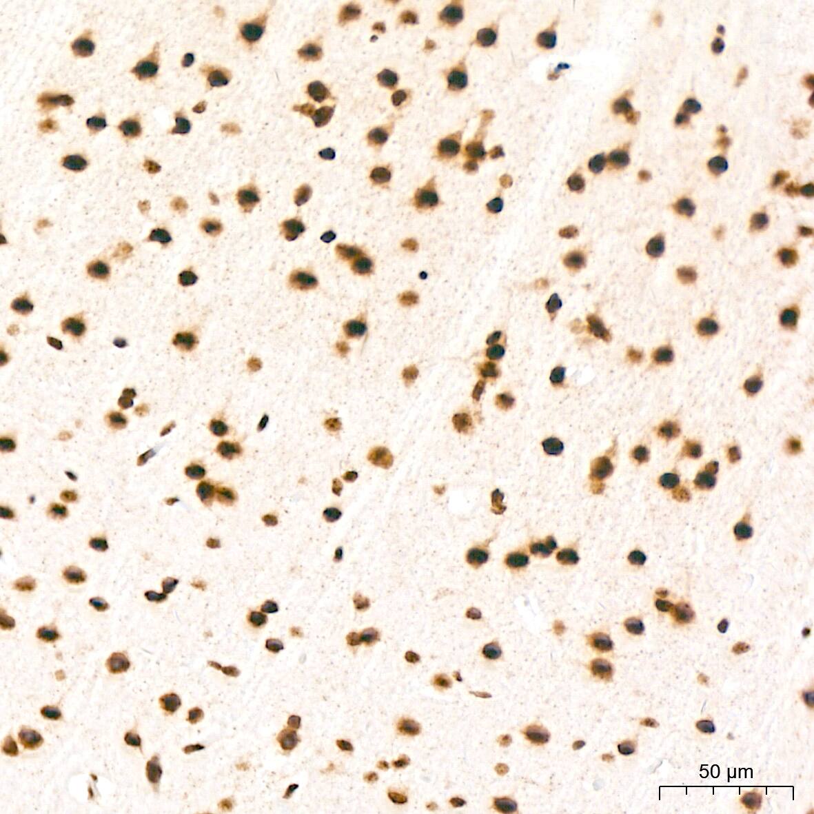 HR6B/UBE2B Antibody (2Z3R2)