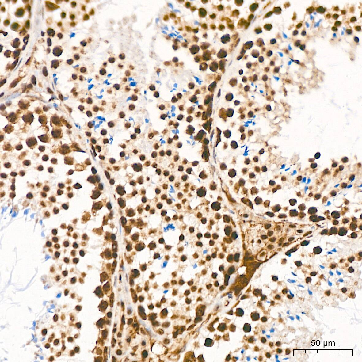 HR6B/UBE2B Antibody (2Z3R2)