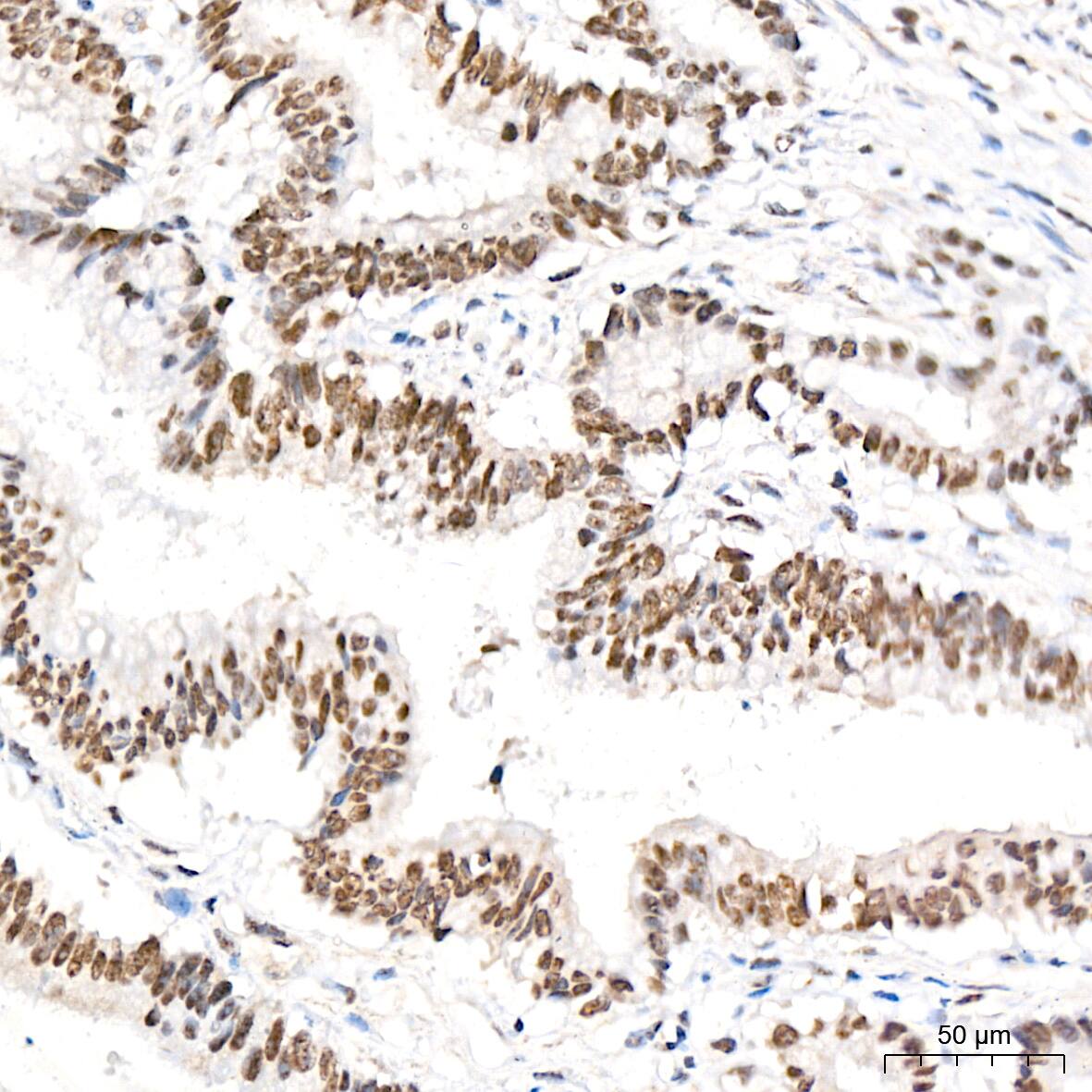 HR6B/UBE2B Antibody (2Z3R2)