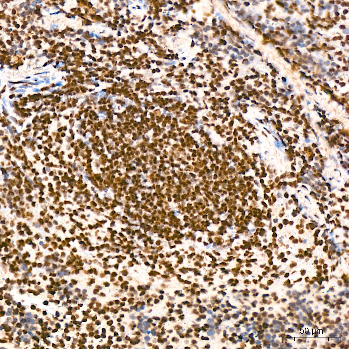 HR6B/UBE2B Antibody (2Z3R2)