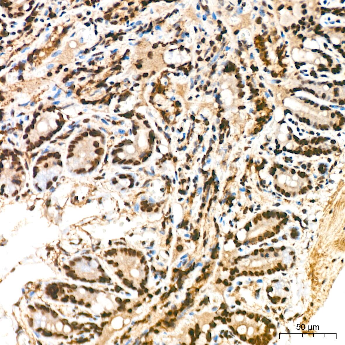 HR6B/UBE2B Antibody (2Z3R2)