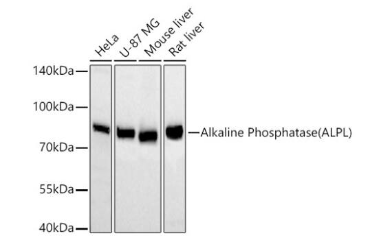 Alkaline Phosphatase/ALPL Antibody (10B1M5)