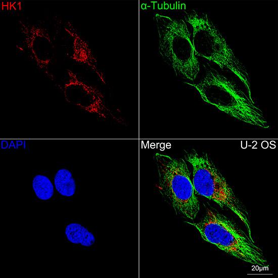Hexokinase 1 Antibody (6B7Q2)