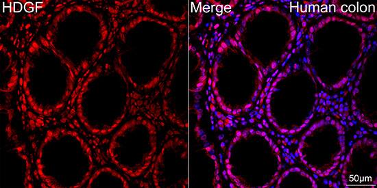 HDGF Antibody (5U7A7)