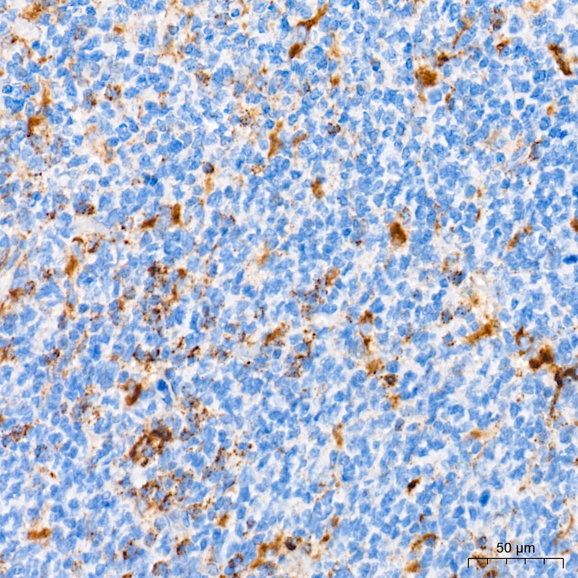 LAMP-2/CD107b Antibody (5N8J3)