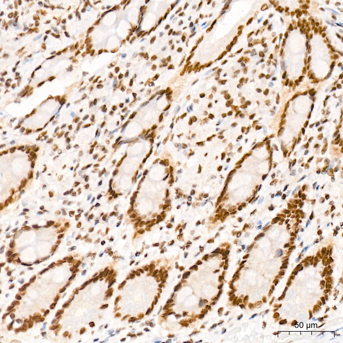 MED4 Antibody (8T5C9)