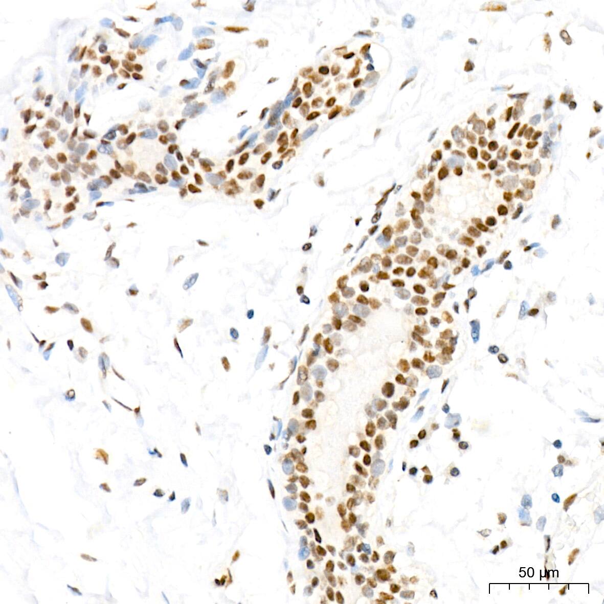 MED4 Antibody (8T5C9)