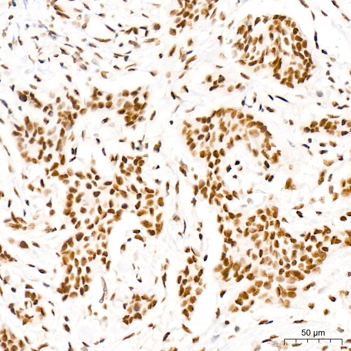 MED4 Antibody (8T5C9)
