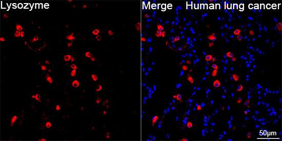 Lysozyme Antibody (9B2O6)