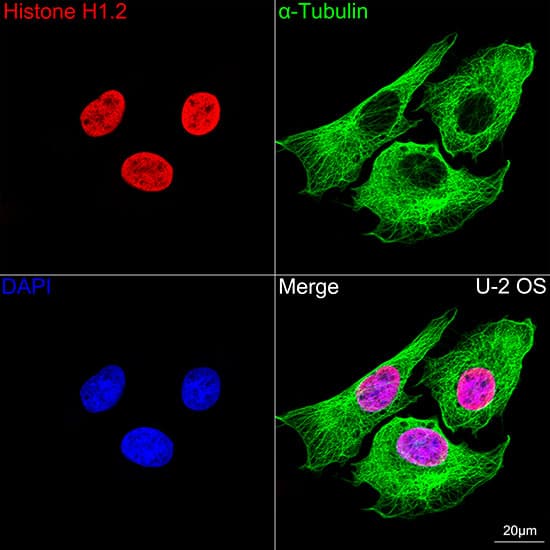 Histone H1.2 Antibody (9T9Q7)