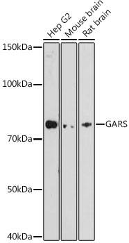 GARS Antibody (5Q5D7)
