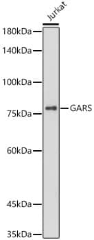 GARS Antibody (5Q5D7)