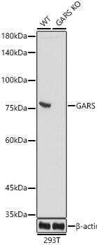 GARS Antibody (5Q5D7)