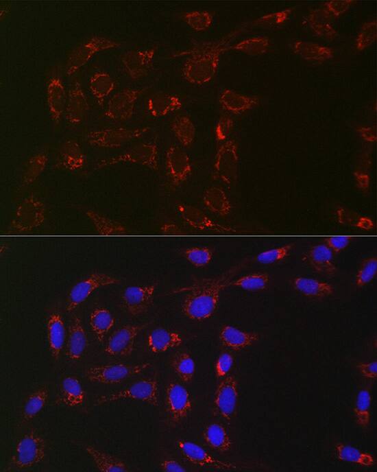 ACAA2 Antibody (8H6H5)