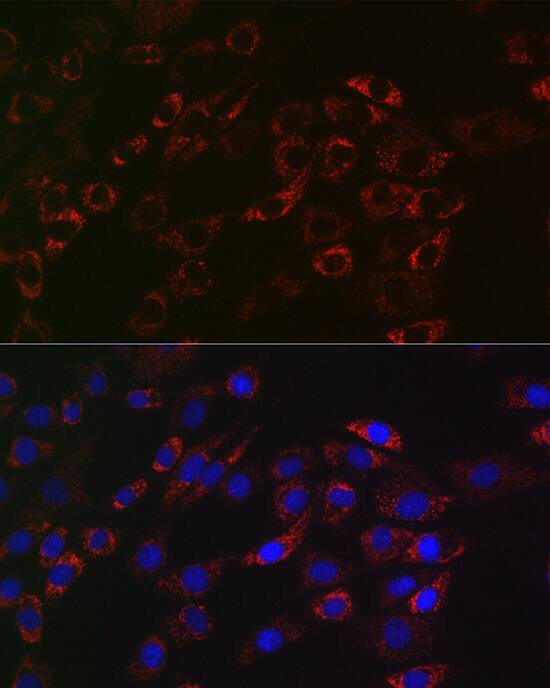 ACAA2 Antibody (8H6H5)