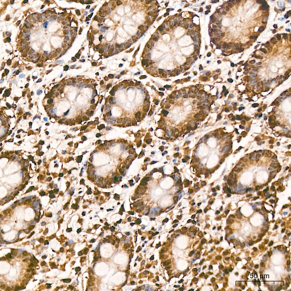 hnRNP K Antibody (3O5Y4)