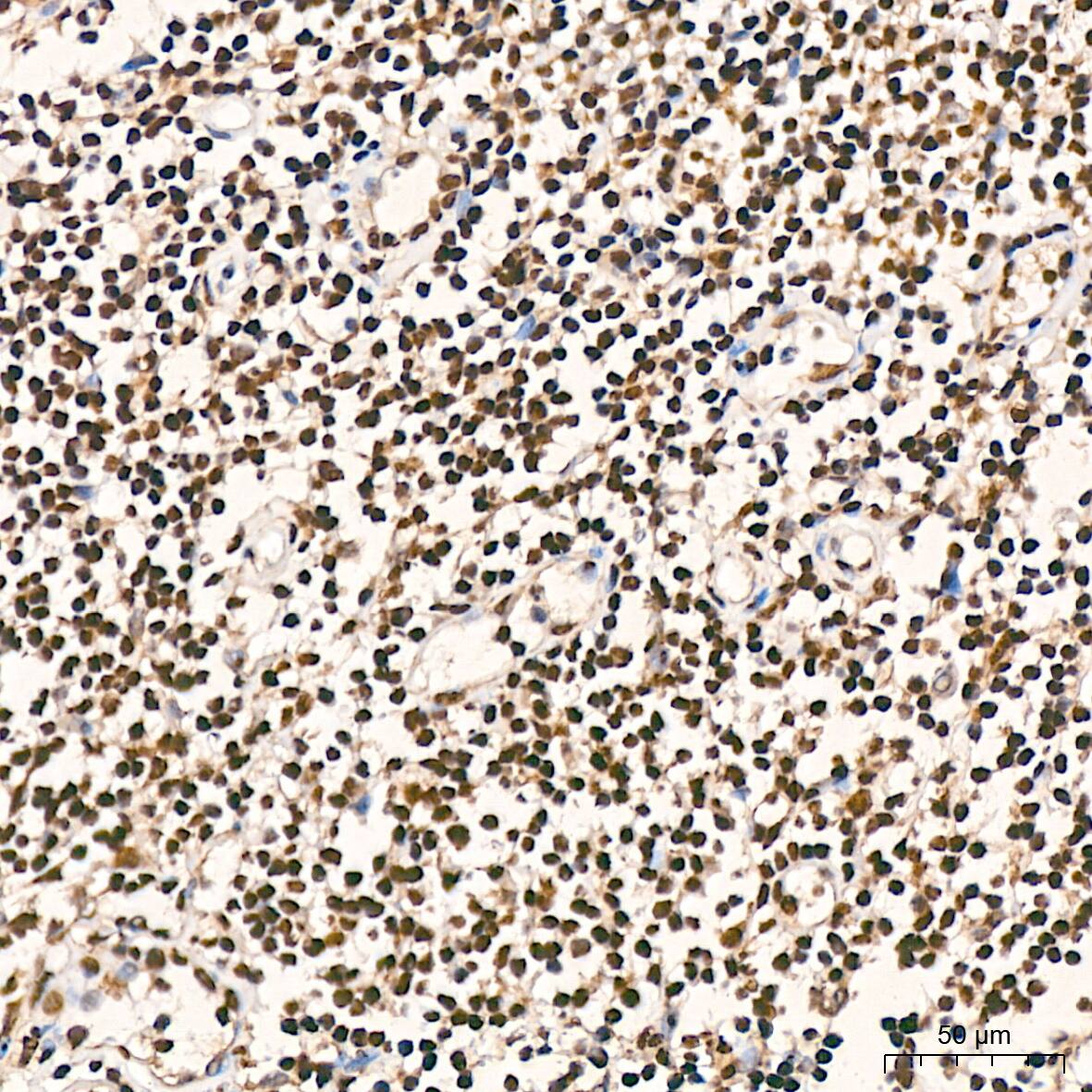 hnRNP K Antibody (3O5Y4)