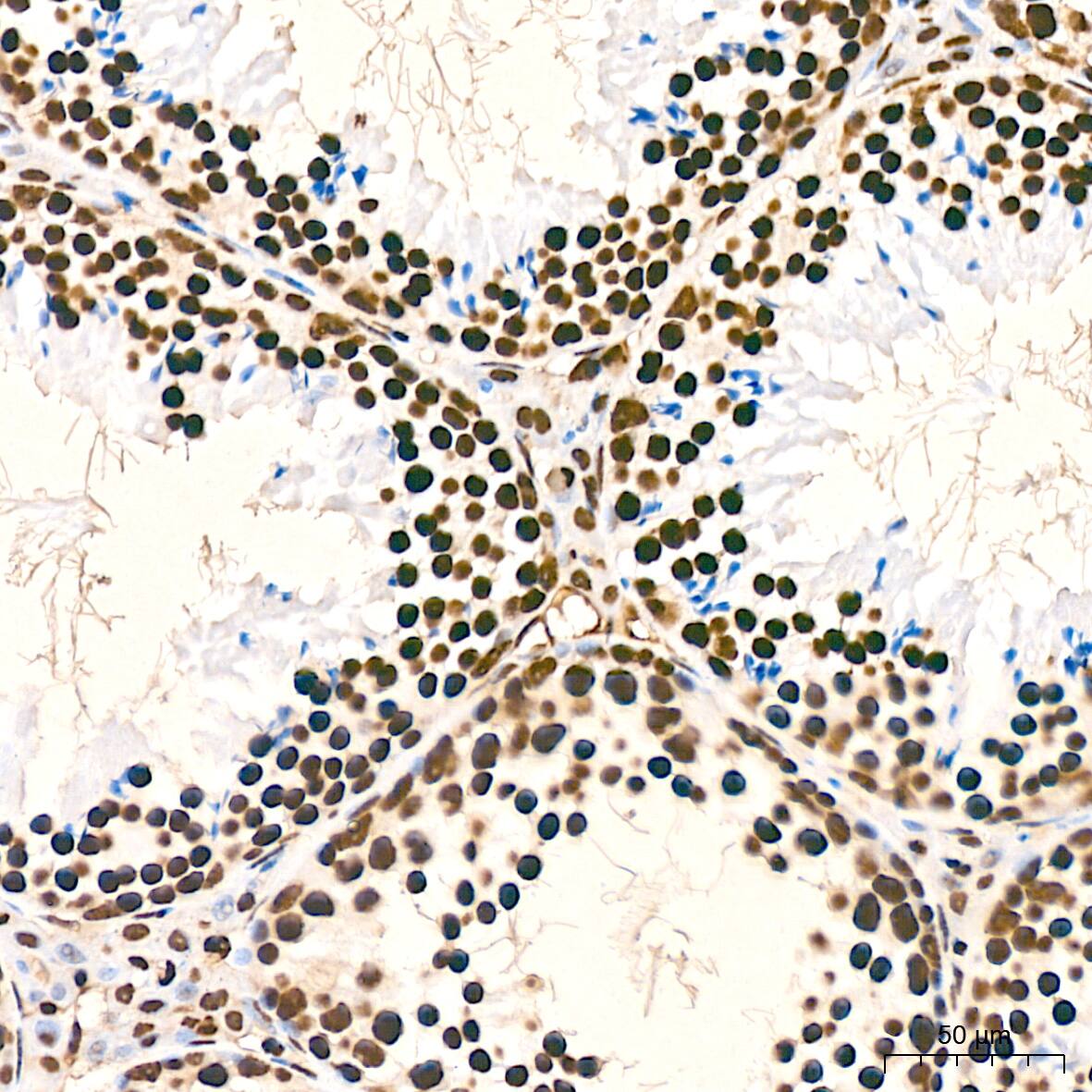 hnRNP K Antibody (3O5Y4)